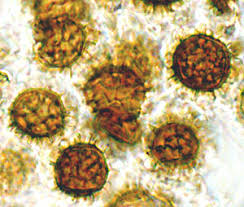 Attēlu rezultāti vaicājumam “Diderma simplex spores”