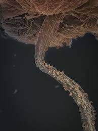 Attēlu rezultāti vaicājumam “Lamproderma pseudomaculatum spores”