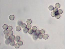 Attēlu rezultāti vaicājumam “Arcyria denudata spores”