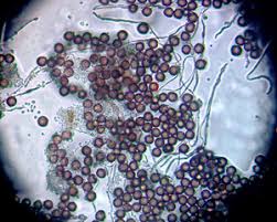 Attēlu rezultāti vaicājumam “Physarum pseudoalexandrowiczii spores”