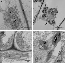 Attēlu rezultāti vaicājumam “Splachnum ampullaceum sporophyte”