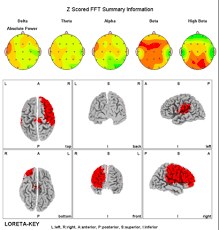 Image result for map of the brain