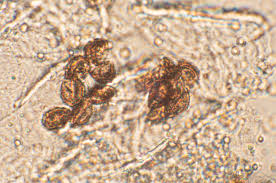 Attēlu rezultāti vaicājumam “Craterium aureum”