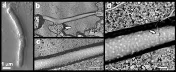 Attēlu rezultāti vaicājumam “Enteridium variabile spores”