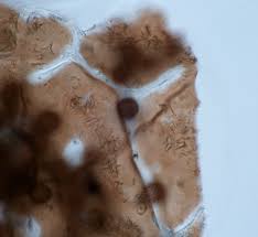 Attēlu rezultāti vaicājumam “Didymium proximum spores”