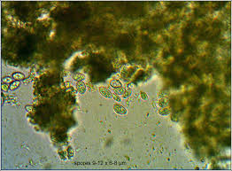 Attēlu rezultāti vaicājumam “Lecanora conizaeoides”