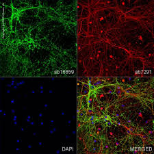 Attēlu rezultāti vaicājumam “Aphodius sp. imago”