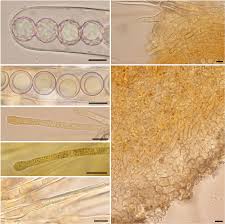 Attēlu rezultāti vaicājumam “Lamprospora tortulae-ruralis”
