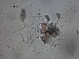 Attēlu rezultāti vaicājumam “Physarum penetrale macro”