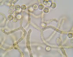 Attēlu rezultāti vaicājumam “Arcyria globosa”