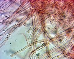 Attēlu rezultāti vaicājumam “Rimbachia neckerae”