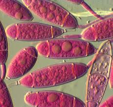 Attēlu rezultāti vaicājumam “Bactridium flavum”