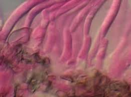 Attēlu rezultāti vaicājumam “Mycosphaerella millegrana”