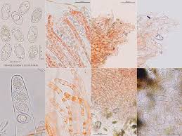 Attēlu rezultāti vaicājumam “Octospora humosa”