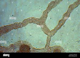 Attēlu rezultāti vaicājumam “Didymium nigripes young”