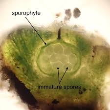 Attēlu rezultāti vaicājumam “Trichia erecta spores”