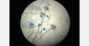 Attēlu rezultāti vaicājumam “Trichia botrytis var. cerifera spores”