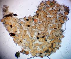 Attēlu rezultāti vaicājumam “Lycogala ustulatum”