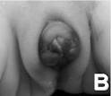 File:Ambiguous <b>genitalia</b>.jpg
