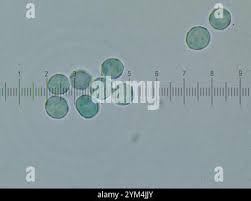 Attēlu rezultāti vaicājumam “Arcyria affinis”