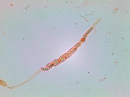 Attēlu rezultāti vaicājumam “Ruzenia spermoides”