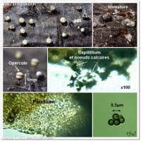 Attēlu rezultāti vaicājumam “Craterium minutum spores”