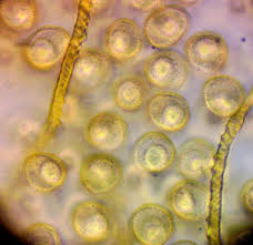 Attēlu rezultāti vaicājumam “Trichia longipalpis spores”