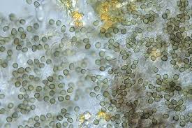 Attēlu rezultāti vaicājumam “Lichenoconium xanthoriae”