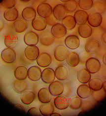Attēlu rezultāti vaicājumam “Licea castanea”