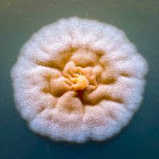 Attēlu rezultāti vaicājumam “Urocystis anemones spores”