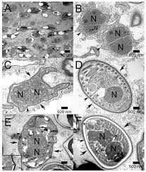 Attēlu rezultāti vaicājumam “Diderma subviridifuscum var. macrospora* sessile”