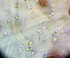 Attēlu rezultāti vaicājumam “Didymium tussilaginis macro”