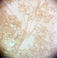 Attēlu rezultāti vaicājumam “Dianema nivale”