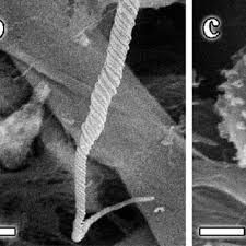 Attēlu rezultāti vaicājumam “Trichia crateriformis spores”