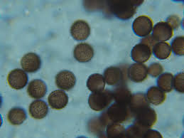 Attēlu rezultāti vaicājumam “Physarum melleum spores”