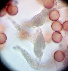 Attēlu rezultāti vaicājumam “Badhamia capsulifera var. arborea”