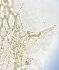 Attēlu rezultāti vaicājumam “Splachnum ampullaceum sporophyte”