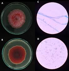 Attēlu rezultāti vaicājumam “Physarum obscurum spores”