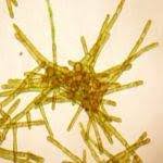 Attēlu rezultāti vaicājumam “Leiocolea rutheana”