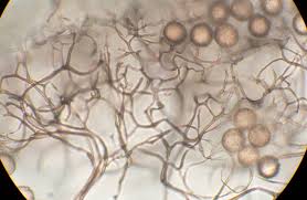 Attēlu rezultāti vaicājumam “Stemonitopsis hyperopta var. landewaldii spores”