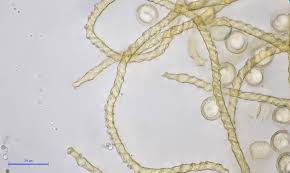 Attēlu rezultāti vaicājumam “Trichia varia”