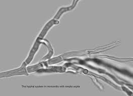 Attēlu rezultāti vaicājumam “Phlebiopsis gigantea”