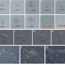 Attēlu rezultāti vaicājumam “Stemonitopsis typhina spores”