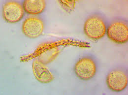 Attēlu rezultāti vaicājumam “Lycogala ustulatum”