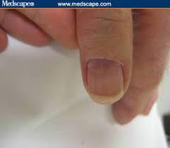 Image result for lunula nail