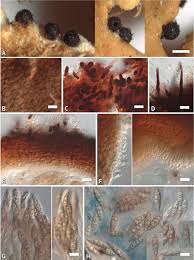 Attēlu rezultāti vaicājumam “Licea castanea spores”
