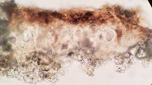 Attēlu rezultāti vaicājumam “Arthonia leucopellaea”