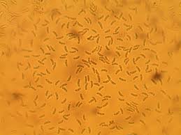 Attēlu rezultāti vaicājumam “Postia caesia”