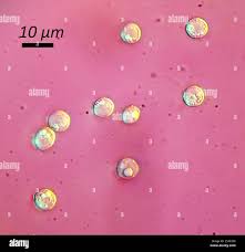 Attēlu rezultāti vaicājumam “Arcyria incarnata spores”