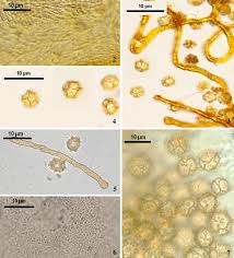 Attēlu rezultāti vaicājumam “Oligonema sp.”